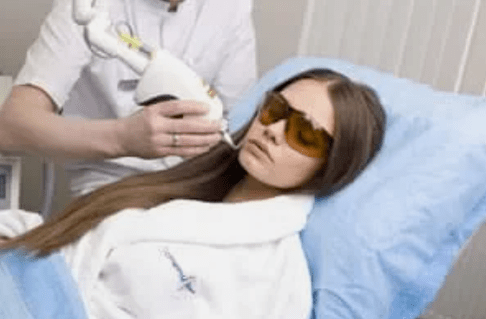 fraksiyonel lazer gençleştirme