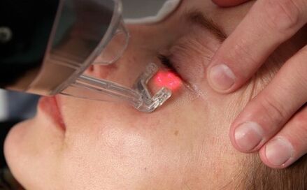lazer yüz cilt gençleştirme prosedürü